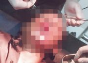 Diduga Mabuk, Oknum Kades Bacok Tiga Warga