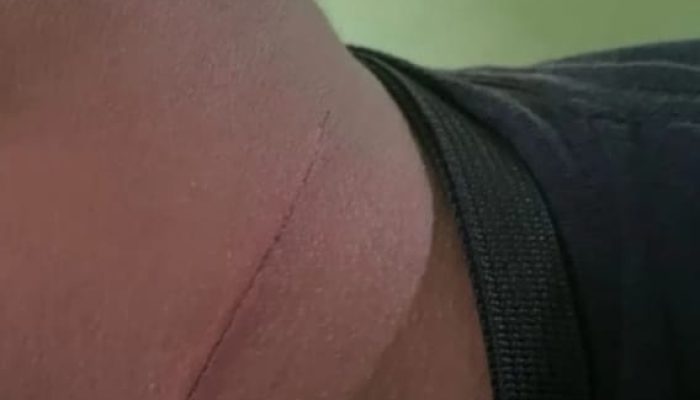 Ojol Nyaris Celaka, Warga Minta Ortu Mengawasi