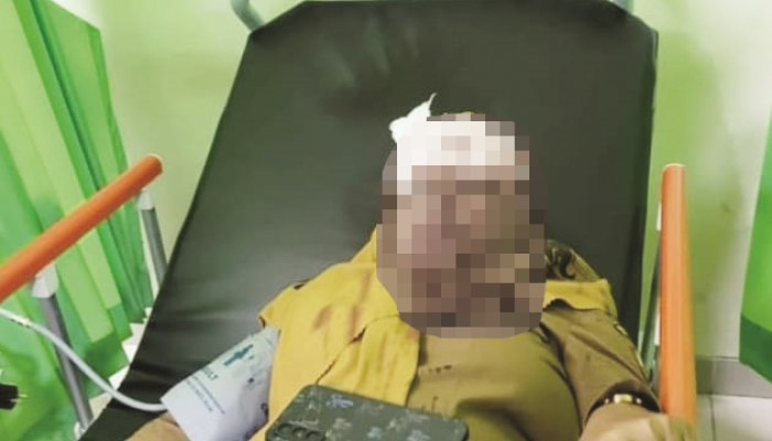 ASN Kotim Jadi Korban Ketiga Benang Layangan