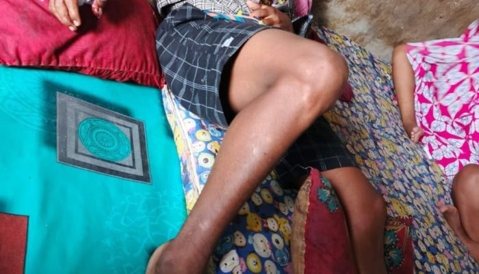 Dua Pekerja Sawit Diserang Beruang di Mentaya Hulu