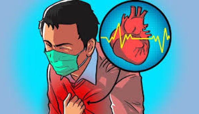 Pria Tewas Depan Rujab Bupati Gumas karena Sakit Jantung